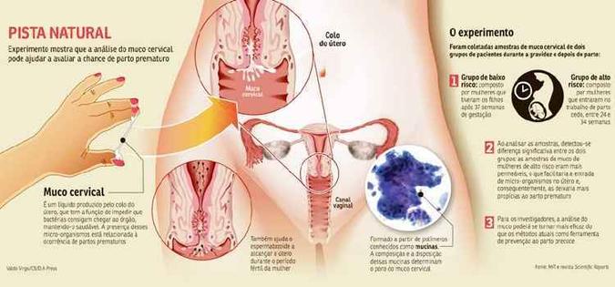 Para o novo estudo, foram coletadas amostras de muco cervical de dois grupos de mulheres durante a gestação e após o parto(foto: Reprodução) Para o novo estudo, foram coletadas amostras de muco cervical de dois grupos de mulheres durante a gestação e após o parto(foto: Reprodução)