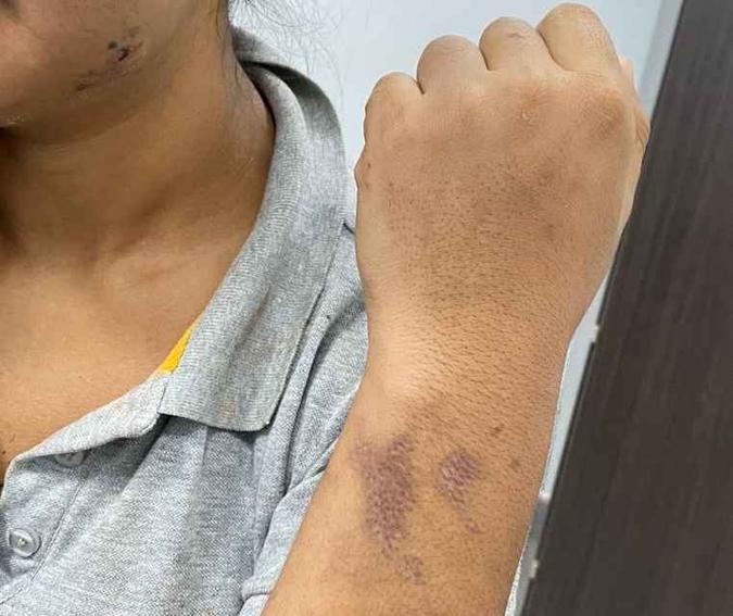 Agressões começaram na véspera de Natal e seguiram até a prisão do autor, na sexta-feira (10/1)(foto: Reprodução) Agressões começaram na véspera de Natal e seguiram até a prisão do autor, na sexta-feira (10/1)(foto: Reprodução)