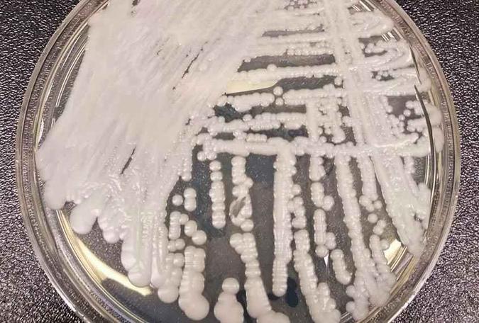 O superfungo Candida auris se prolifera quando o sistema imunológico está debilitado: transmissão por contato(foto: CDC/Divulgação ) O superfungo Candida auris se prolifera quando o sistema imunológico está debilitado: transmissão por contato(foto: CDC/Divulgação )