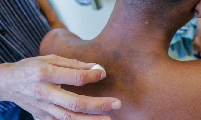 (foto: SMS de Mesquita/ RJ)