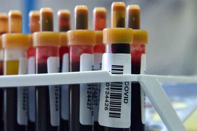 Estruturas de defesa estavam no sangue de 98% das pessoas até 41 dias depois de elas terem os primeiros sintomas(foto: AFP / Vasily MAXIMOV) Estruturas de defesa estavam no sangue de 98% das pessoas até 41 dias depois de elas terem os primeiros sintomas(foto: AFP / Vasily MAXIMOV)