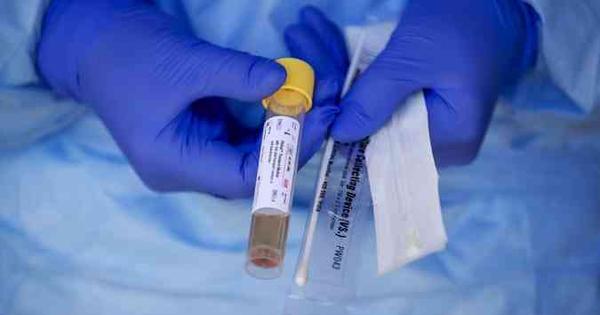 Covid-19: com 1.285 novos casos em menos de 24 horas DF tem novo recorde