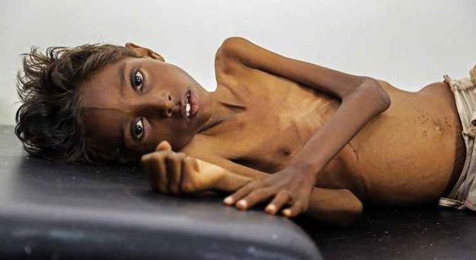(foto: Moohialdin Fuad/UNICEF) (foto: Moohialdin Fuad/UNICEF)