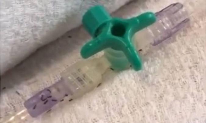 Os insetos também foram encontrados em tubos de acesso para injeção de remédios e sondas de oxigênio(foto: Reprodução/ Internet/ Youtube) Os insetos também foram encontrados em tubos de acesso para injeção de remédios e sondas de oxigênio(foto: Reprodução/ Internet/ Youtube)