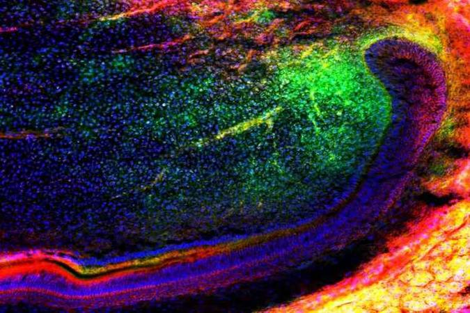 Células-tronco mesenquimais (em verde) migram para um dente para regenerá-lo(foto: University of Plymouth/Divulgação) Células-tronco mesenquimais (em verde) migram para um dente para regenerá-lo(foto: University of Plymouth/Divulgação)