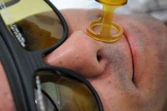 Depilação a laser na barba(foto: Iano Andrade/CB/D.A Press) Depilação a laser na barba(foto: Iano Andrade/CB/D.A Press)