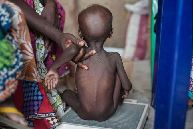 Países latino-americanos e africanos fazem parte da lista: autores alertam para os impactos da má nutrição desde a infância e para a necessidade da participação de diferentes atores sociais para mudar esse quadro (foto: AFP / STEFAN HEUNIS) Países latino-americanos e africanos fazem parte da lista: autores alertam para os impactos da má nutrição desde a infância e para a necessidade da participação de diferentes atores sociais para mudar esse quadro (foto: AFP / STEFAN HEUNIS)