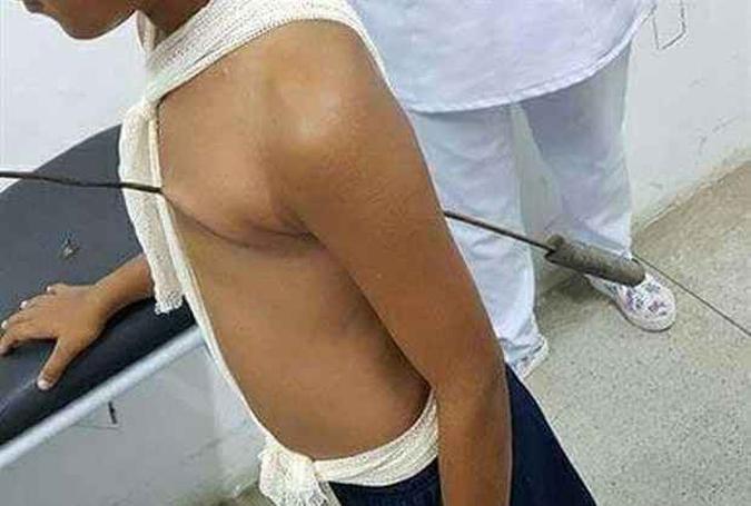 Menino foi transferido para o Recife e operado no Hospital da Restauração(foto: Reprodução da internet/Divulgação ) Menino foi transferido para o Recife e operado no Hospital da Restauração(foto: Reprodução da internet/Divulgação )
