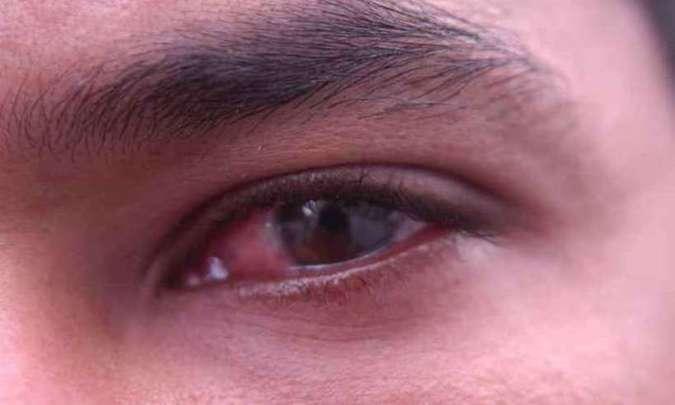 (foto: Beto Magalh�es/EM)