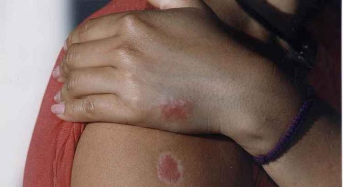 O trabalho inédito faz parte da campanha 16 Dias de Ativismo pelo Fim da Violência contra as Mulheres(foto: Jefferson Rudy/CB/D.A Press) O trabalho inédito faz parte da campanha 16 Dias de Ativismo pelo Fim da Violência contra as Mulheres(foto: Jefferson Rudy/CB/D.A Press)