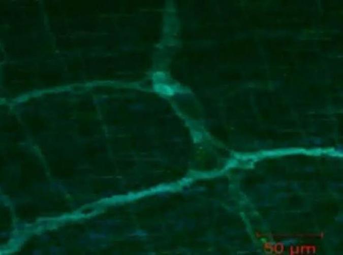 Células nervosas do intestino em ação (verde): mais de 100 milhões(foto: Xiling Shen/Duke University) Células nervosas do intestino em ação (verde): mais de 100 milhões(foto: Xiling Shen/Duke University)