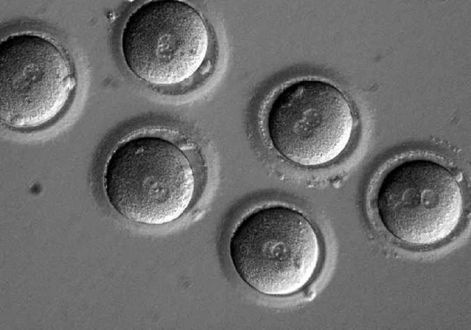 Imagem de embriões após concluída a edição genética: 72% das amostras foram corrigidas(foto: Oregon Health & Science University/Nature) Imagem de embriões após concluída a edição genética: 72% das amostras foram corrigidas(foto: Oregon Health & Science University/Nature)