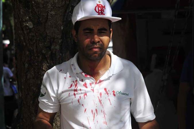O enfermeiro Nildo Arantes foi agredido durante uma briga entre manifestantes contrários e a favor do projeto do Executivo(foto: Minervino Júnior/CB/D.A Press) O enfermeiro Nildo Arantes foi agredido durante uma briga entre manifestantes contrários e a favor do projeto do Executivo(foto: Minervino Júnior/CB/D.A Press)