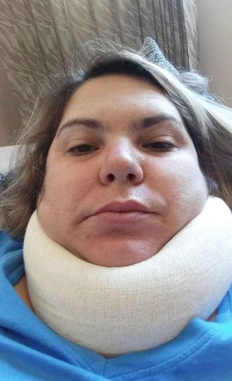 Rejane Freitas foi medicada e deverá usar um colar cervical enquanto se recupera da lesão na coluna, causada por um empurrão durante o desentendimento(foto: Arquivo pessoal) Rejane Freitas foi medicada e deverá usar um colar cervical enquanto se recupera da lesão na coluna, causada por um empurrão durante o desentendimento(foto: Arquivo pessoal)