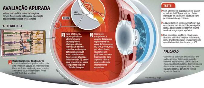 (foto: Valdo Virgo/CB/D.A Press)