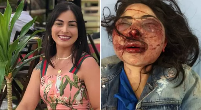Imagem mostra antes e depois de vítima ser espancada no Espírito Santo(foto: Divulgação/Rede Social e Polícia Militar ) Imagem mostra antes e depois de vítima ser espancada no Espírito Santo(foto: Divulgação/Rede Social e Polícia Militar )