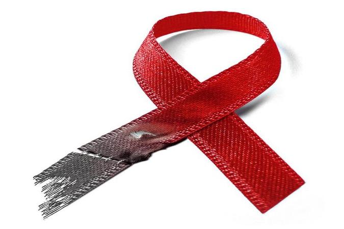 Além de reforçar a importância da terapia imediata, a descoberta poderá ajudar na criação de vacinas para a Aids(foto: Amaro Jr./CB/D.A Press) Além de reforçar a importância da terapia imediata, a descoberta poderá ajudar na criação de vacinas para a Aids(foto: Amaro Jr./CB/D.A Press)