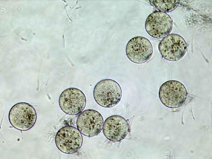 Imagem de um processo de fertilização in vitro(foto: Genome Research Limited / Divulg) Imagem de um processo de fertilização in vitro(foto: Genome Research Limited / Divulg)