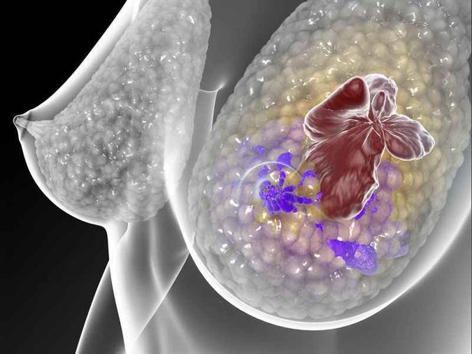 (foto: Chris Bickel/Science Translational Medicine) (foto: Chris Bickel/Science Translational Medicine)