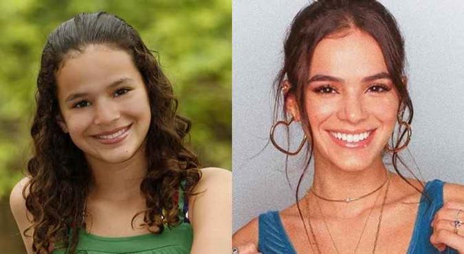 Bruna, mais nova, e em uma foto recente no seu Instagram: rinoplastia(foto: Carta Z Noticias e Instagram/Reprodução) Bruna, mais nova, e em uma foto recente no seu Instagram: rinoplastia(foto: Carta Z Noticias e Instagram/Reprodução)