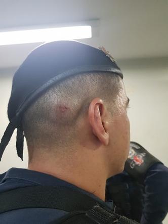 Policial militar foi agredido com um cabo de vassoura de ferro(foto: Reprodução/PMDF) Policial militar foi agredido com um cabo de vassoura de ferro(foto: Reprodução/PMDF)
