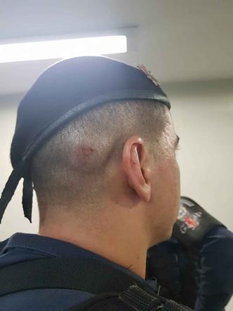 O policial foi ferido na cabeça com um cabo de vassoura(foto: PMDF/Divulgação) O policial foi ferido na cabeça com um cabo de vassoura(foto: PMDF/Divulgação)