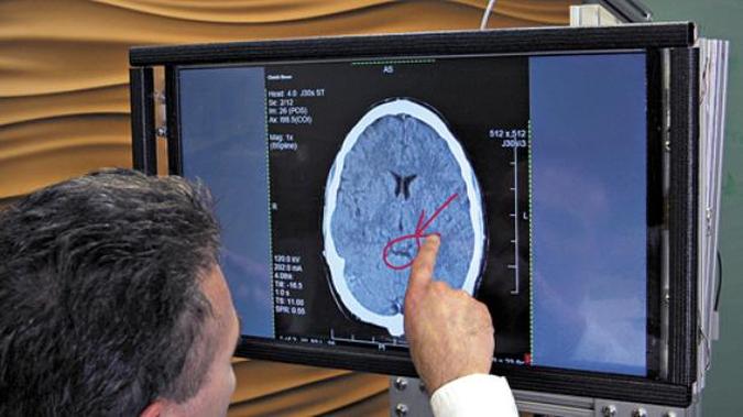O dispositivo foi testado por um profissional de saúde: pelo toque, ele conseguiu examinar tecidos de um cérebro humano (foto: Microsoft Research/Divulgação) O dispositivo foi testado por um profissional de saúde: pelo toque, ele conseguiu examinar tecidos de um cérebro humano (foto: Microsoft Research/Divulgação)