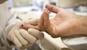Diagnóstico precoce do vírus HIV e o início do tratamento é considerado o método mais eficaz de prevenir mortes por aids e causas associadas(foto: Arquivo/Agência Brasil) Diagnóstico precoce do vírus HIV e o início do tratamento é considerado o método mais eficaz de prevenir mortes por aids e causas associadas(foto: Arquivo/Agência Brasil)