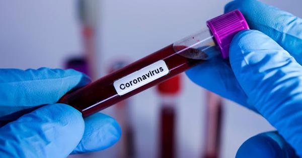 S&atilde;o Paulo registra 483,9 mil casos e 21,6 mil mortes por covid-19