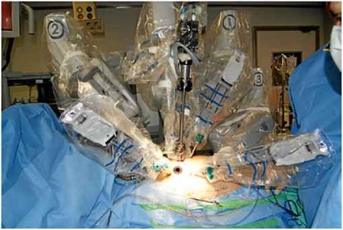 Sistema robótico Da Vinci, usado por médicos em cirurgias: para os entrevistados, as máquinas não têm competência, apesar da precisão dos movimentos e de seus resultados (foto: Robinson Poffo/Divulgação ) Sistema robótico Da Vinci, usado por médicos em cirurgias: para os entrevistados, as máquinas não têm competência, apesar da precisão dos movimentos e de seus resultados (foto: Robinson Poffo/Divulgação )