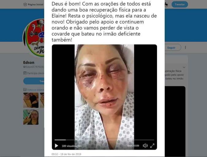 Empresária aparece com o rosto inchado e ferido em vídeo postado no Twitter (foto: Twitter/Reprodução ) Empresária aparece com o rosto inchado e ferido em vídeo postado no Twitter (foto: Twitter/Reprodução )