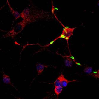 Parasita da toxoplasmose (verde) infectando um neurônio humanos (vermelho)(foto: I-PingLee/Divulgacao) Parasita da toxoplasmose (verde) infectando um neurônio humanos (vermelho)(foto: I-PingLee/Divulgacao)