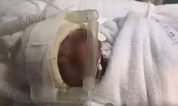 Bebê internado na maternidade foi alvo da infestação de formigas no CTI neonatal da maternidade(foto: Reprodução/ Internet/ Youtube ) Bebê internado na maternidade foi alvo da infestação de formigas no CTI neonatal da maternidade(foto: Reprodução/ Internet/ Youtube )
