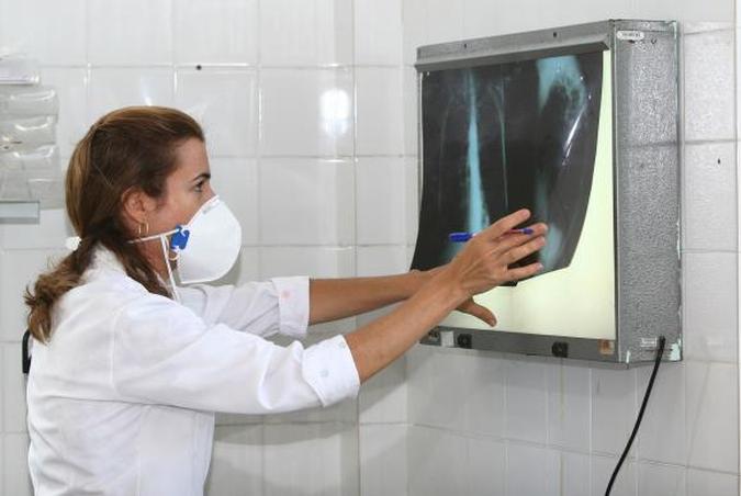 É necessário ficar atento aos sintomas da tuberculose para dar início ao tratamento e, com isso, interromper a contaminação das outras pessoas(foto: Agecom Bahia ) É necessário ficar atento aos sintomas da tuberculose para dar início ao tratamento e, com isso, interromper a contaminação das outras pessoas(foto: Agecom Bahia )
