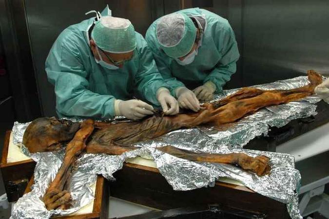 Encontrado congelado nos Alpes Ötzal, em 1991, o corpo de Ötzi estava completamente preservado. Por isso, vem sendo usado em vários estudos(foto: SouthtyrolarchaeologymuseumEuracM.Samadelli/Divulgação) Encontrado congelado nos Alpes Ötzal, em 1991, o corpo de Ötzi estava completamente preservado. Por isso, vem sendo usado em vários estudos(foto: SouthtyrolarchaeologymuseumEuracM.Samadelli/Divulgação)