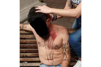 Defensores do Escola Sem Partido denunciam agressões após debate na USP