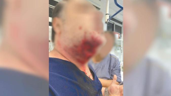 Por pouco, o médico não levou mordida na veia jugular, com a ferimento ficando à milímetros de atingir(foto: Reprodução/Twitter) Por pouco, o médico não levou mordida na veia jugular, com a ferimento ficando à milímetros de atingir(foto: Reprodução/Twitter)
