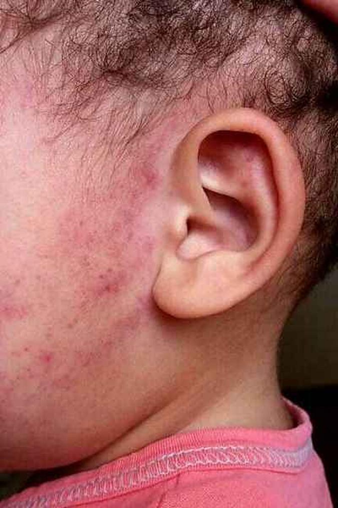 A docente notou o hematoma e denunciou a agressão(foto: Polícia Civil de Goiás/Divulgação) A docente notou o hematoma e denunciou a agressão(foto: Polícia Civil de Goiás/Divulgação)