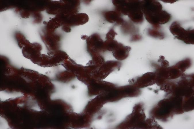 Pesquisadores têm se dedicado a entender mecanismos ligados a esses grupos de micro-organismos presentes em áreas como o intestino e o aparelho urinário(foto: M. Dodd/Divulgação) Pesquisadores têm se dedicado a entender mecanismos ligados a esses grupos de micro-organismos presentes em áreas como o intestino e o aparelho urinário(foto: M. Dodd/Divulgação)