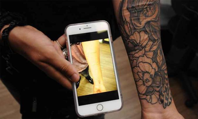 Tatuagem no braço de Franco: cicatrizes de tentativa de suicídio viraram flores e agora fazem parte do passado do jovem(foto: Ramon Lisboa/EM/D.A Press) Tatuagem no braço de Franco: cicatrizes de tentativa de suicídio viraram flores e agora fazem parte do passado do jovem(foto: Ramon Lisboa/EM/D.A Press)