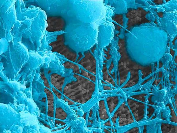 Neurônios (azul) crescem sobre a prótese: atuação em conjunto(foto: UC San Diego/Divulgação ) Neurônios (azul) crescem sobre a prótese: atuação em conjunto(foto: UC San Diego/Divulgação )